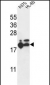 RPL17 Antibody (C-term)